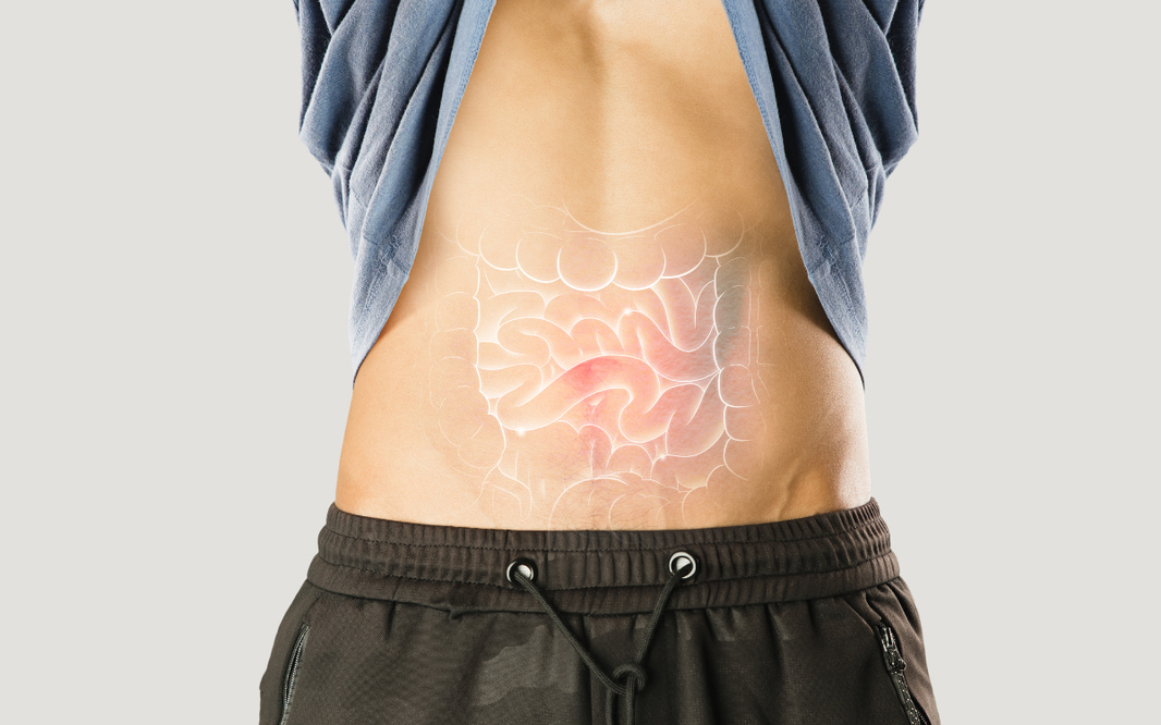 ¿Qué es y para qué sirve un test de disbiosis intestinal?